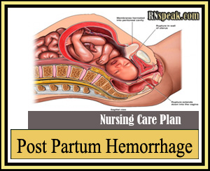 Postpartum Care Plan