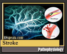 stroke pathophysiology diagram