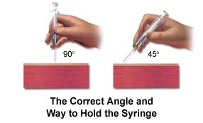 Injection site reaction steroids