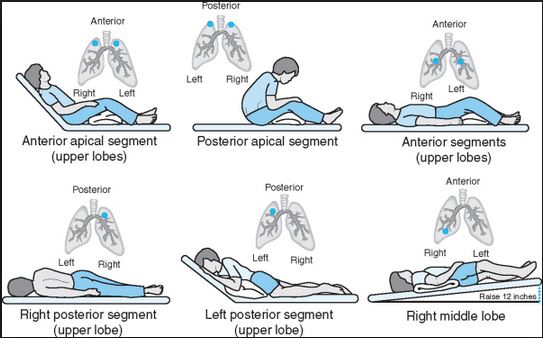 postural drainage positions pdf