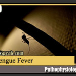Dengue Fever132