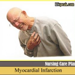 Myocardial-Infarction-old man