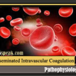 Disseminated Intravascular Coagulation (DIC) Pathophysiology