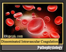 Disseminated Intravascular Coagulation (DIC) Pathophysiology | RNspeak