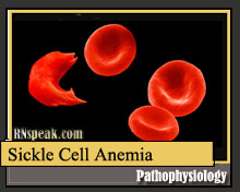 Sickle Cell Anemia | RNspeak