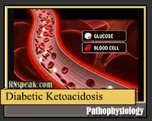 Diabetic-ketoacidosis-pathophysiology | RNspeak