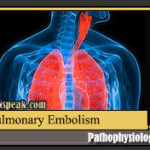 pulmonary-embolism-pathophysiology