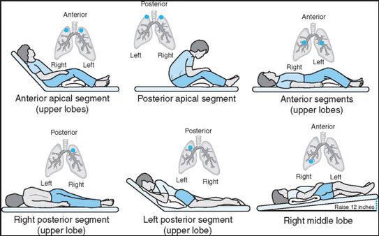 postural drainage positions