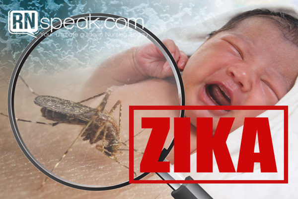 zika virus microcephaly