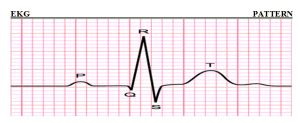 The 6 Steps Method On How To Interpret Electrocardiogram Results Easily 