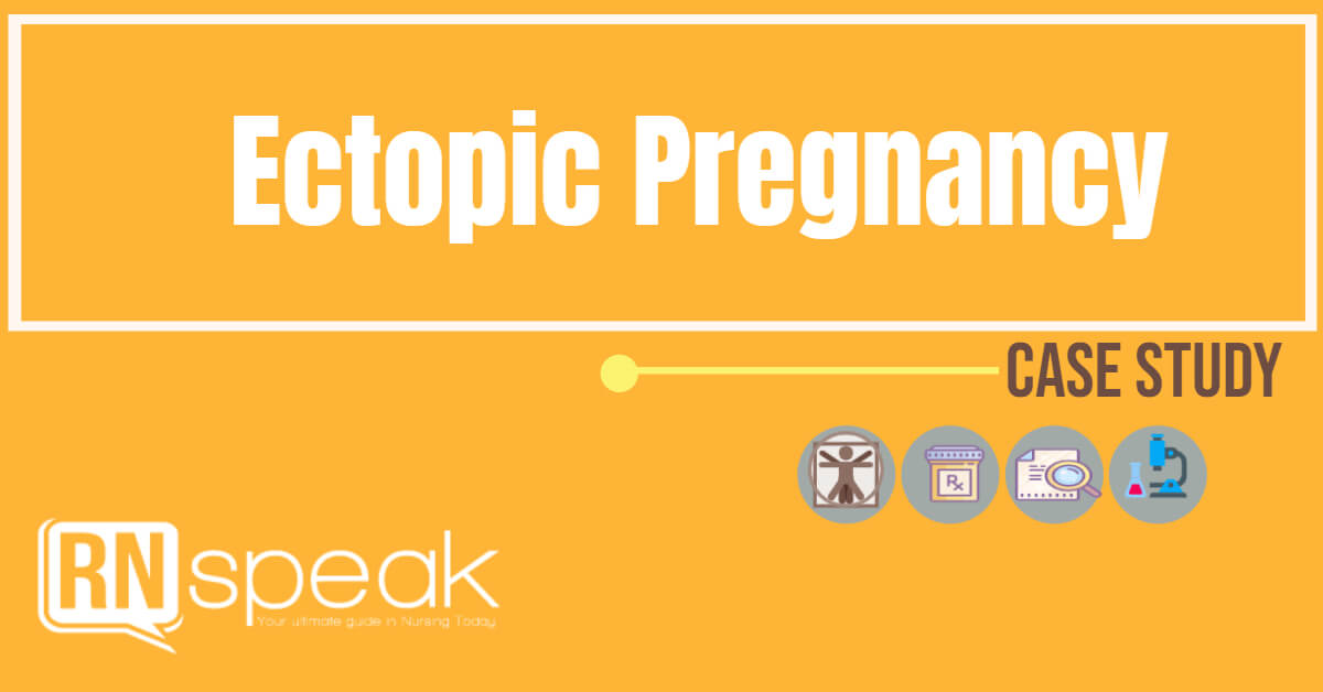 ectopicpregnancy case study
